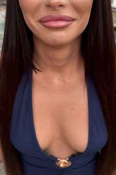Anne, 35 Jahre